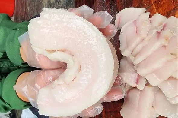 หญิงวัย 56 ปี กินไขมันหมูทุกวัน ผ่านไปปีครึ่ง หมอเห็นผลตรวจถึงกับตะลึง