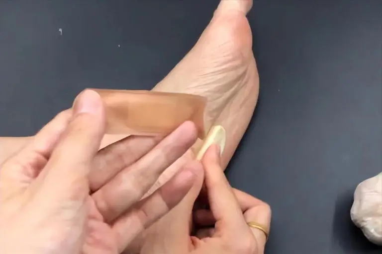 ทุกคืนก่อนนอน เธอหั่นกระเทียมสด 2 ชิ้น แปะไว้ที่ฝ่าเท้า ผ่านไป 6 เดือน ผลตรวจสุขภาพของเธอทำ