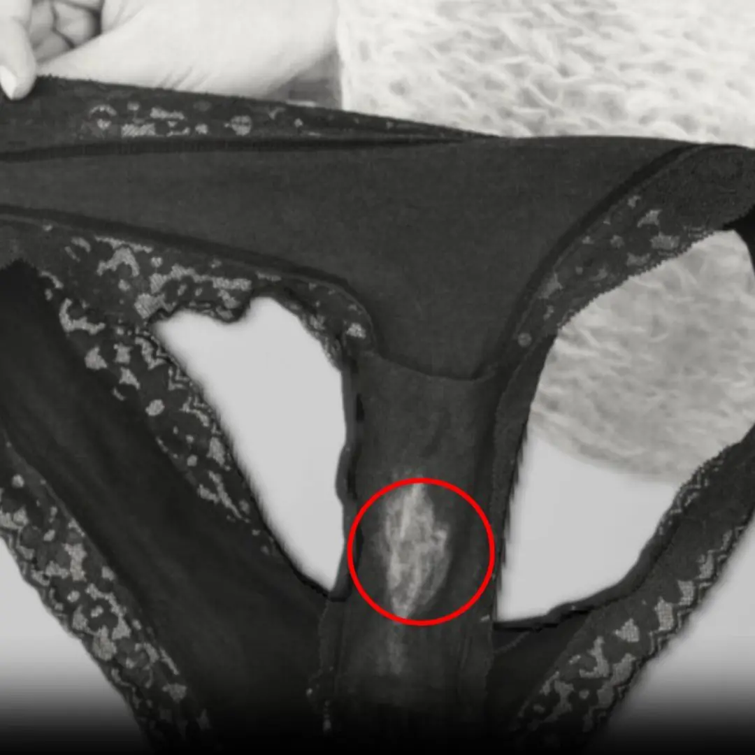 รอย “เหมือนฟอกสี” บนกางเกงใน เกิดจากอะไร? เรื่องใกล้ตัวของผู้หญิงที่ควรรู้ให้ลึกกว่านี้