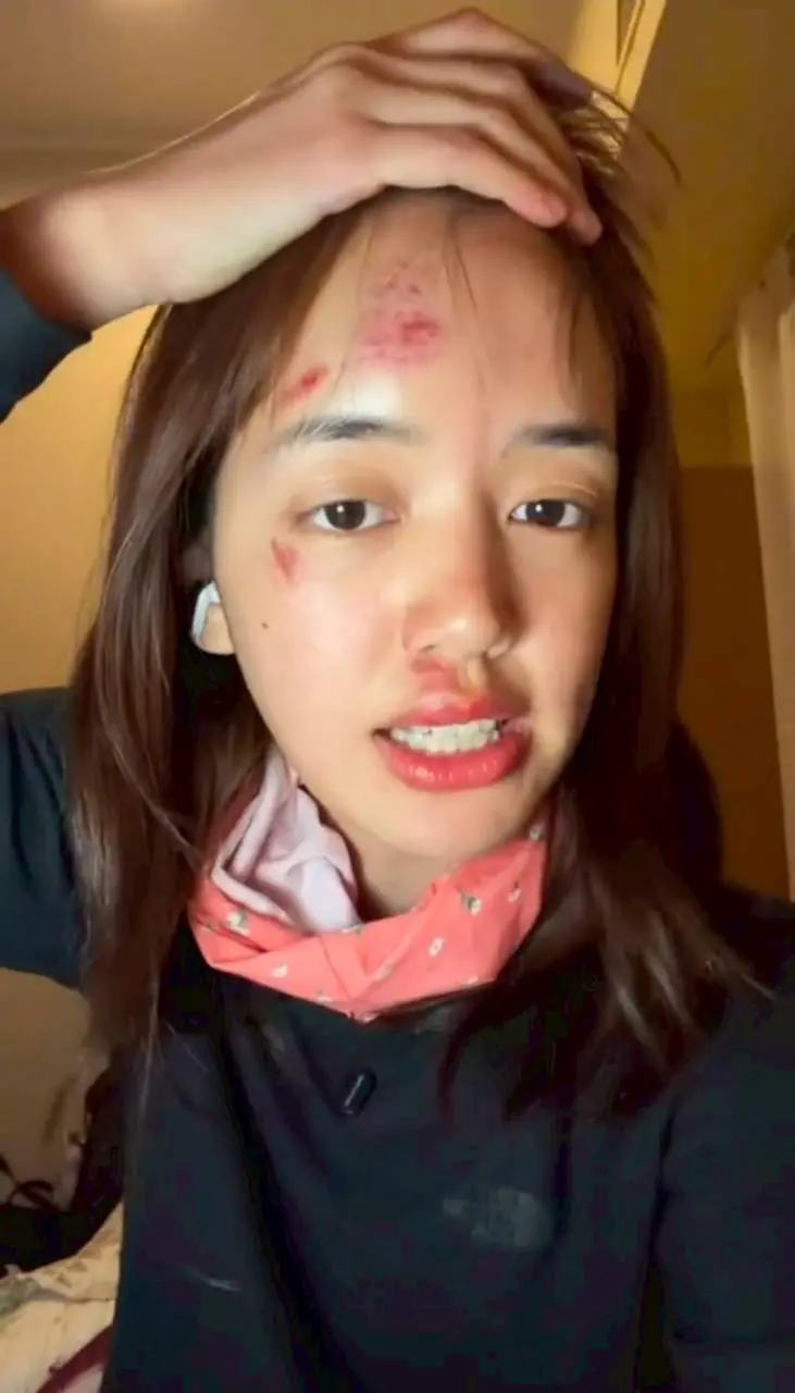 หัวข้อรองรับการค้นหา: อุทาหรณ์นักเดินทาง ดาราสาวหน้าเหวอะหลังจบทริปล่องเรือขั้วโลกใต้