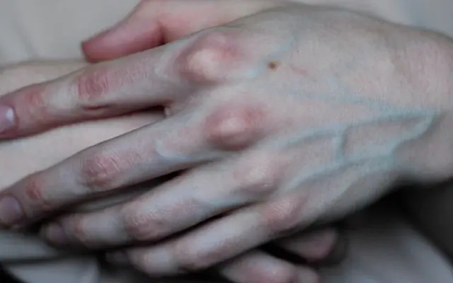 เส้นเลือดสีเขียวปูดชัด 3 จุดนี้ กำลังเตือนว่าร่างกายมีปัญหา: อันตราย อย่ามองข้ามเด็ดขาด