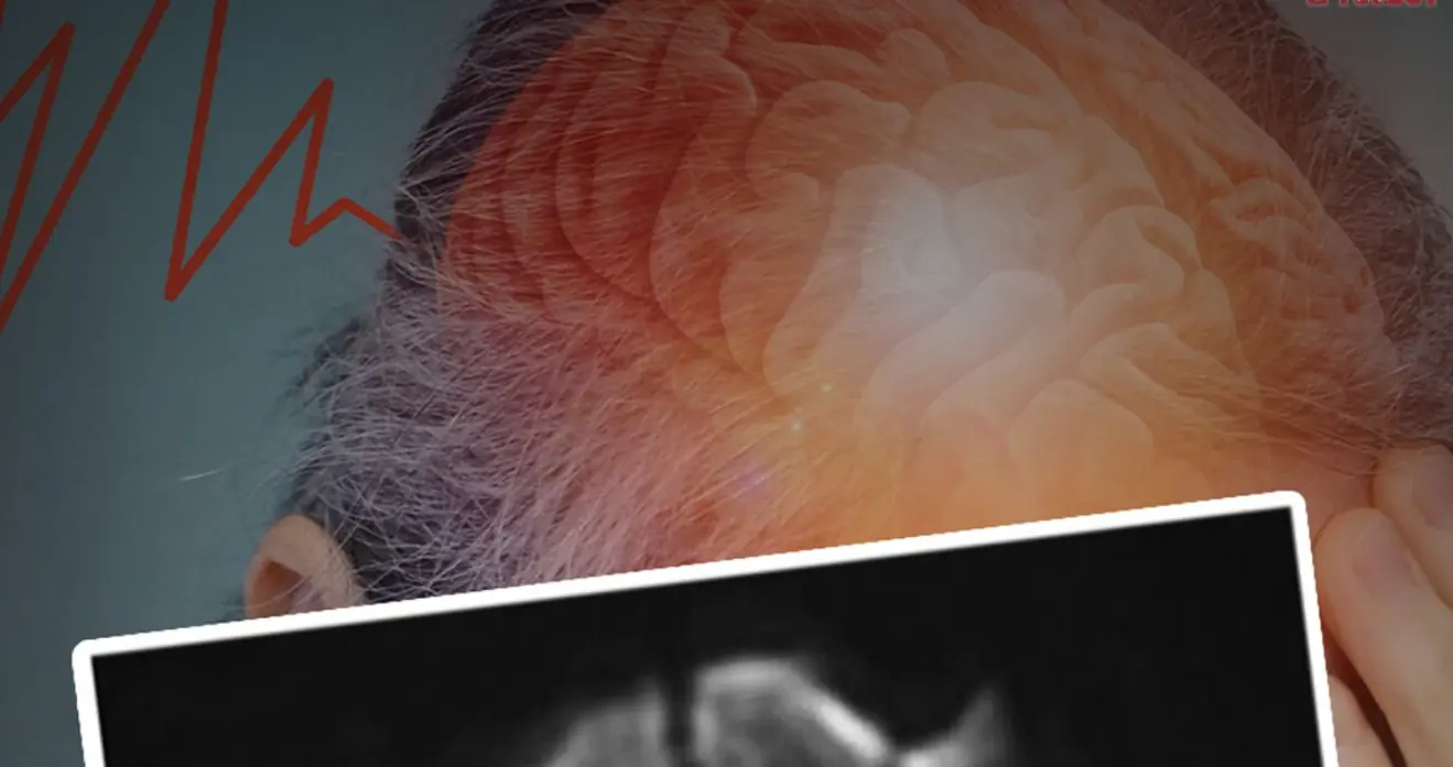 หมอเตือน! 7 พฤติกรรมก่อนนอนสุดเสี่ยงทำสมองขาดเลือด