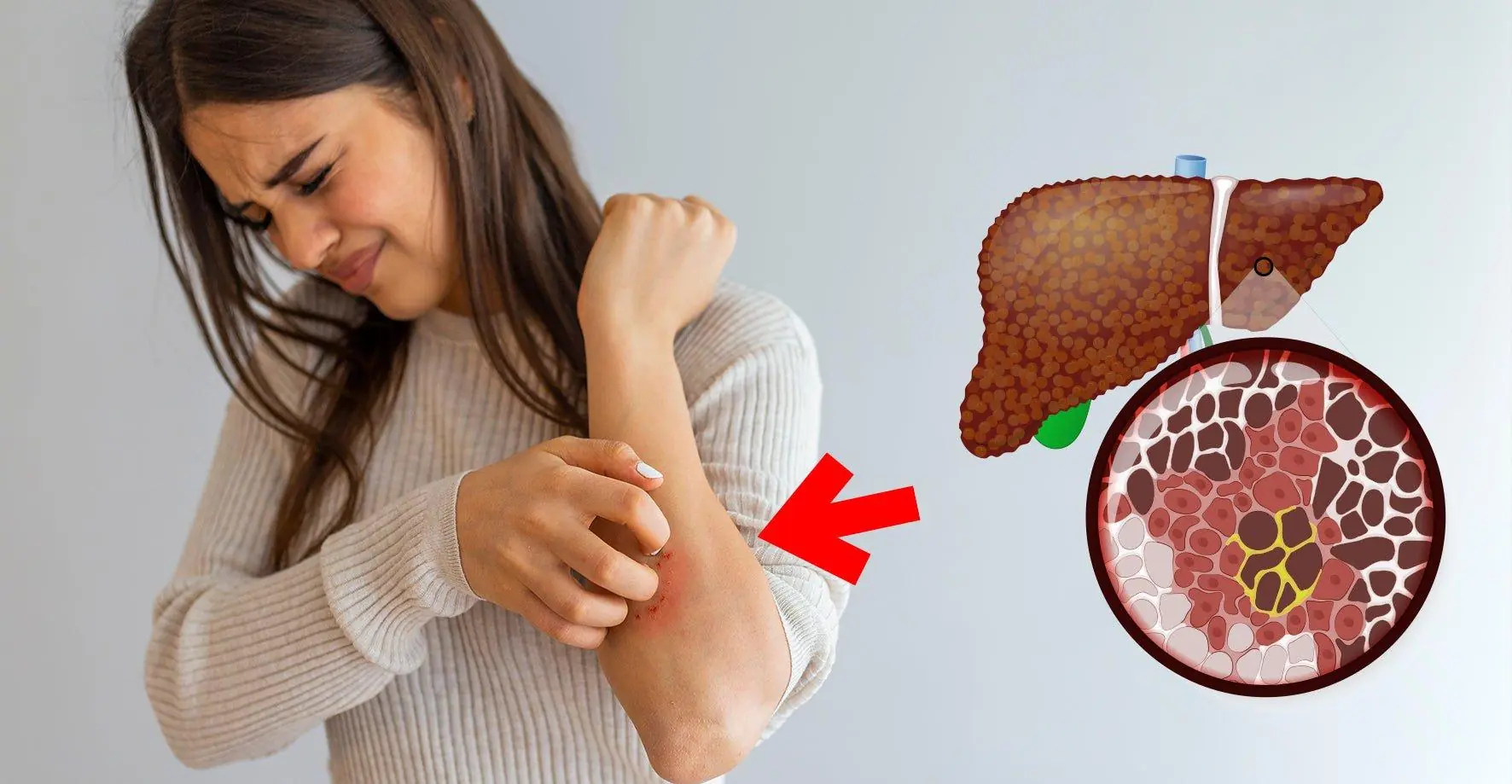 5 สัญญาณในตอนกลางคืนของผู้ที่ตับเสื่อมรุนแรง