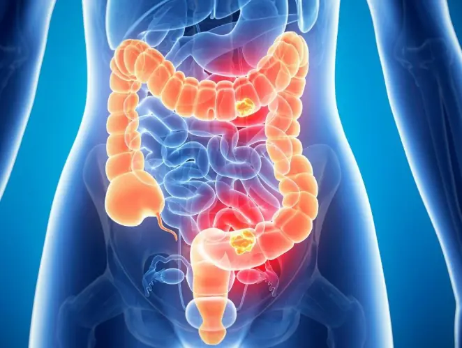 วิจัยญี่ปุ่นพบ พืช 1 ชนิด กินแล้วดีท็อกซ์ลำไส้ใน 24 ชม. ฮีโร่ระบบขับถ่าย ปกป้องตับ