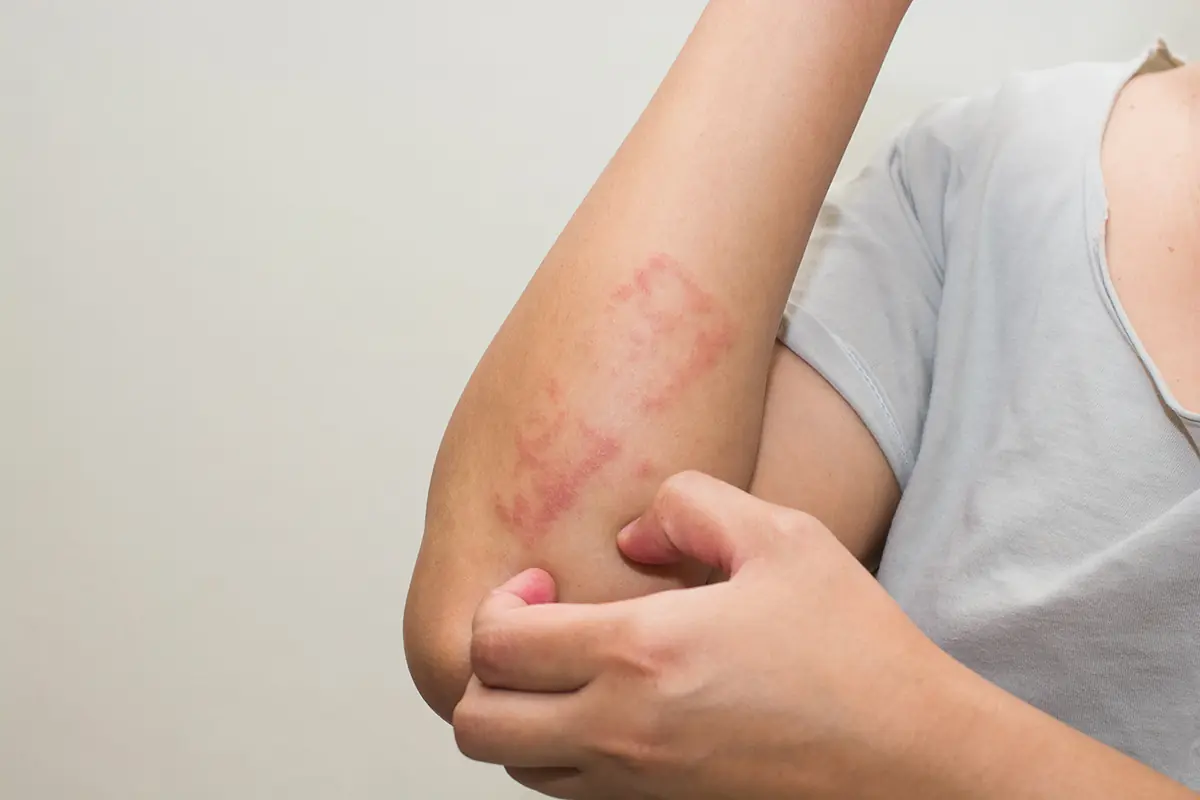 อย่ามองข้าม 10 สัญญาณเตือนมะเร็ง เพื่อปกป้องสุขภาพของคุณ