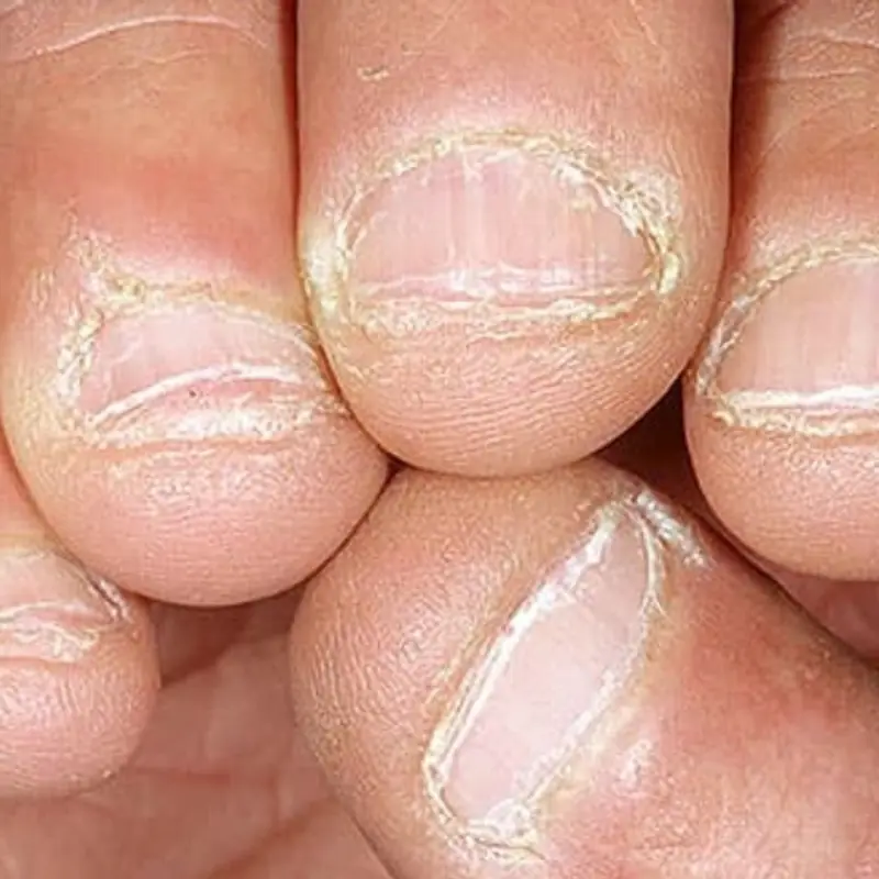 หากเล็บของคุณมีอาการทั้ง 10 อย่างนี้ ควรไปพบแพทย์ทันที