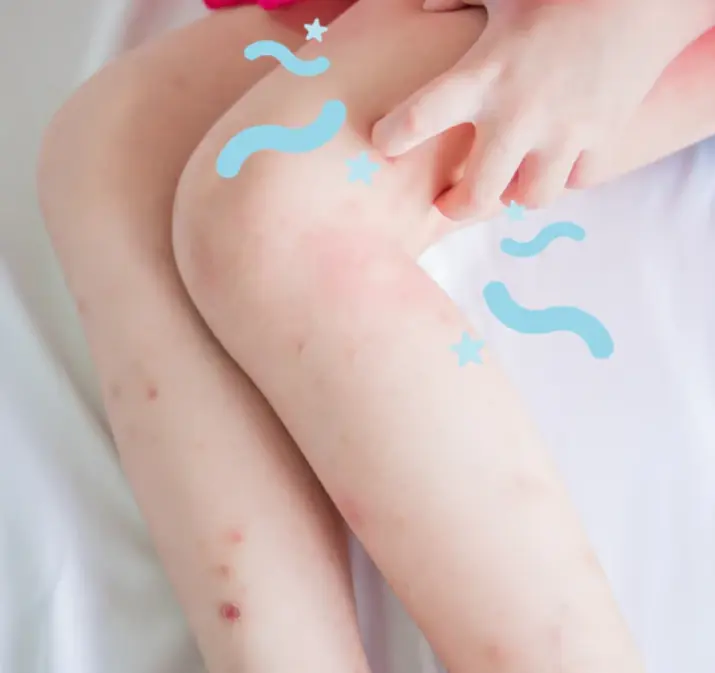 เหตุใดลูกของคุณจึงคันมากขึ้นในเวลากลางคืน