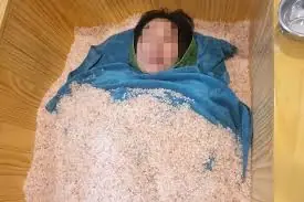 กระแสฝังตัวในทรายร้อนเพื่อลดรอบเอว 6 ซม. กำลังเป็นไวรัลในโซเชียล แพทย์ออกมาเตือน