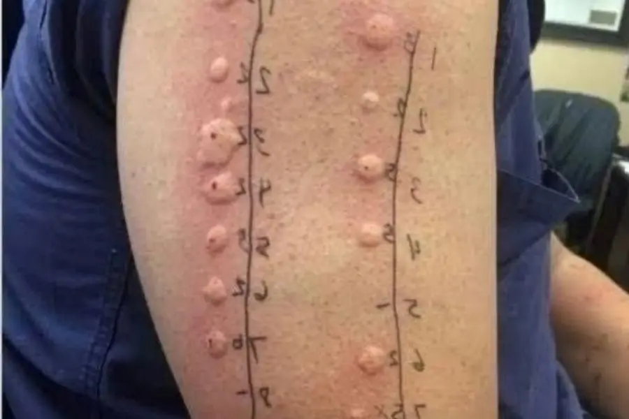 นี่คือผลที่ตามมาจากการนอนกับ...