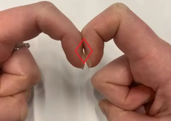 วิธีสังเกตความผิดปกติของร่างกายผ่านปลายนิ้ว: สัญญาณเตือนที่ไม่ควรละเลย