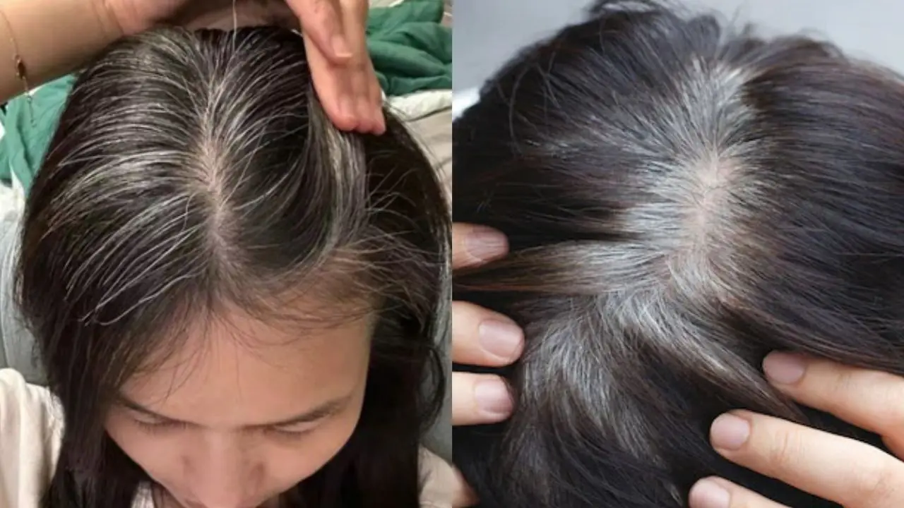 3 กลุ่มคนที่ผมหงอกก่อนวัยง่าย แค่อายุ 30 กว่าก็ขาวเต็มศีรษะ