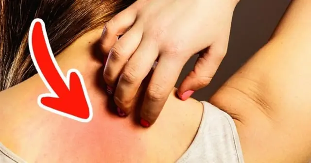 มะ.เร็.งอย่าปล่อยให้สายเกินไป: แพทย์เตือน 6 สัญญาณที่ไม่ควรมองข้าม