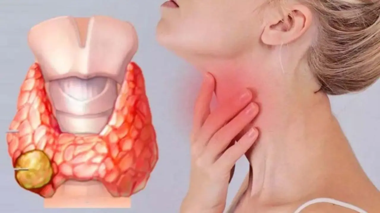 5 สัญญาณเตือนม.ะเ.ร็.งไทรอยด์ระยะที่ 1 รู้เร็ว ช่วยยืดอายุได้