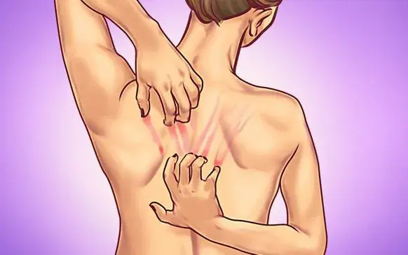 คันเรื้อรังใน 4 ตำแหน่งนี้: สัญญาณเตือนมะเร็งตับระยะเริ่มต้น ที่คนไทยจำนวนมากกำลังมองข้าม