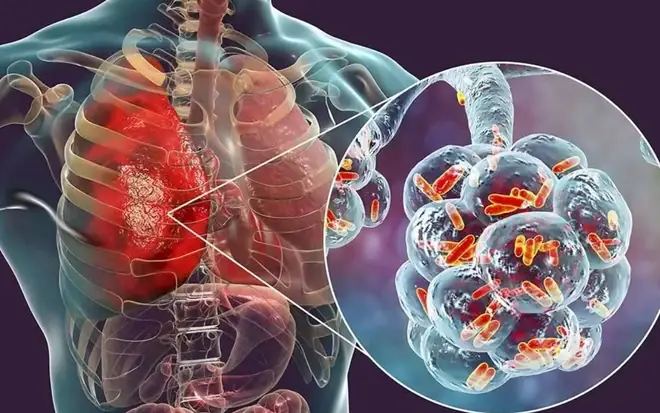 5 สัญญาณเตือน “ม.ะเ.ร็.งระยะเริ่มต้น” ที่คุณไม่ควรมองข้าม