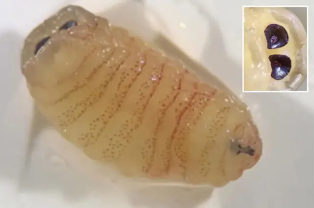 สุดช็อก หญิงวัย 58 ปี จามออกมาเป็นหนอน สาเหตุที่คาดไม่ถึง