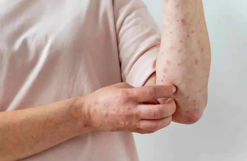 หากไตของคุณอยู่ในภาวะอันตราย ร่างกายจะแสดงสัญญาณเหล่านี้ให้คุณทราบ!