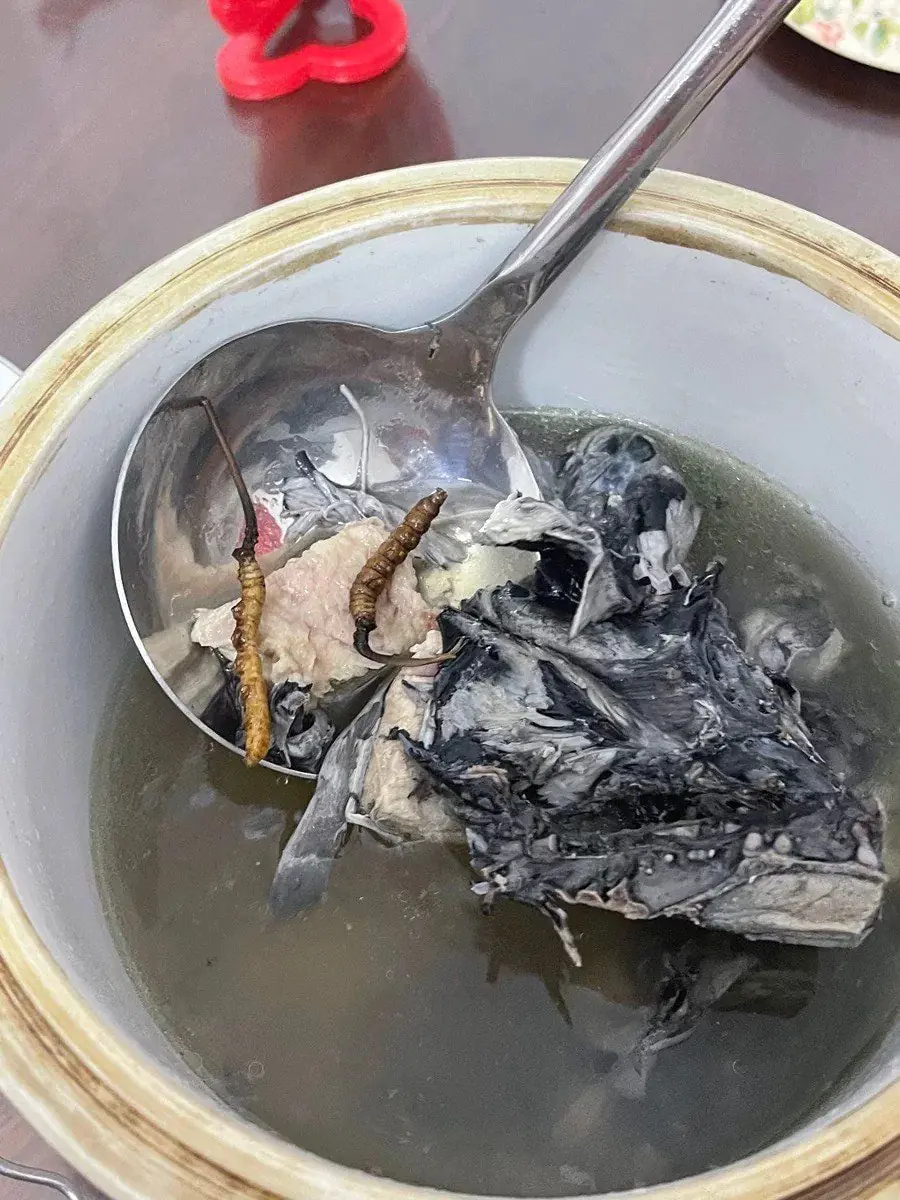 ชายวัย 65 ปีเกือบต้องล้างไต แพทย์แนะซุป 5 ชนิดที่ไม่ควรรับประทานบ่อย