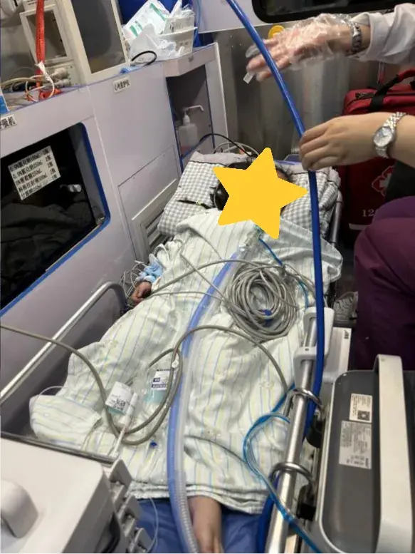 เด็ก 2 ขวบ หัวใจหยุดเต้น-สมองบวม หมอพบ "สิ่งนี้" ติดในหลอดลม อุทาหรณ์สำลักอาหาร!