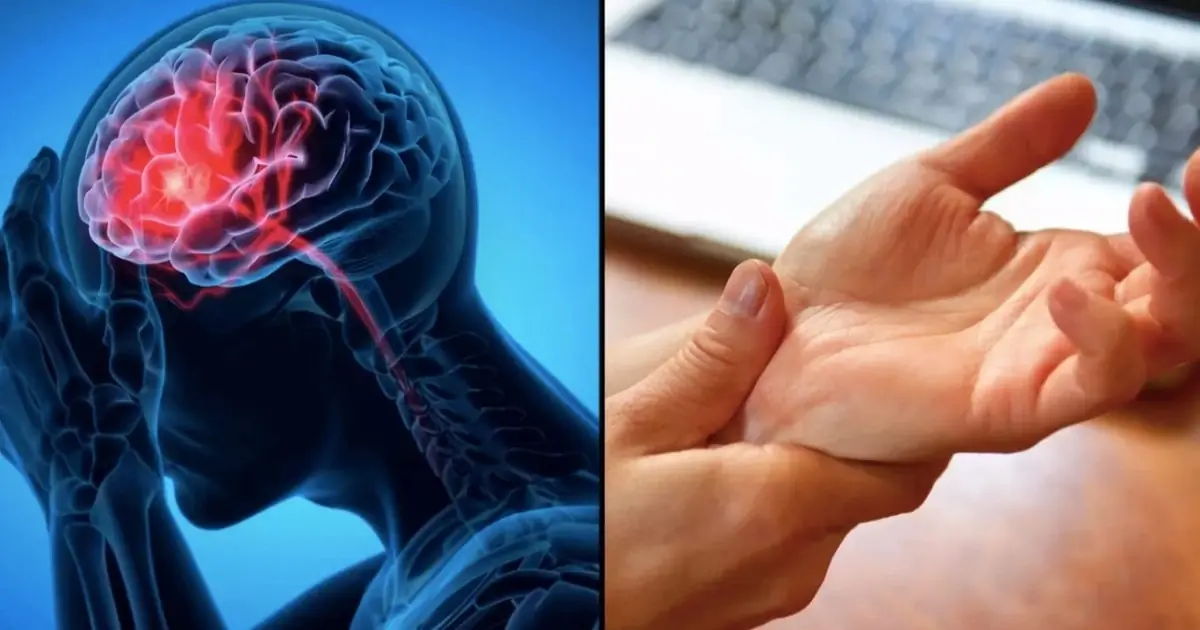 5 สัญญาณเตือนอันตรายของโรคหลอดเลือดสมอง; บุคคล 4 กลุ่มต่อไปนี้มีความเสี่ยงสูงสุด