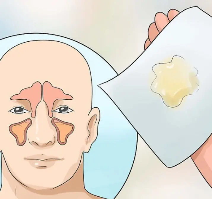 ทำไมคอถึงรู้สึกมีเสมหะเหนียว? เผยสาเหตุที่แท้จริงเบื้องหลังความรู้สึกเหนียวข้นในลำคอ