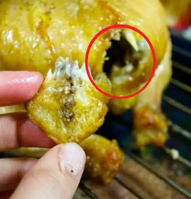 อุทาหรณ์กินไก่ทำพิษ! ว่าที่เจ้าบ่าวเกือบสิ้นชื่อ แพทย์เตือนด่วน