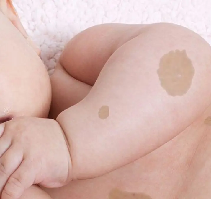 เด็กที่มีปาน 10 ตำแหน่งนี้ เชื่อกันว่าเป็นสัญญาณแห่งโชคลาภและความมั่งคั่ง