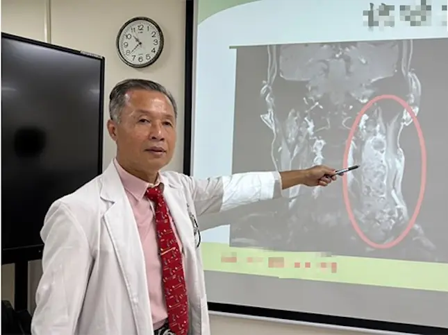 ชายวัย 60 ปีใช้ชีวิตสุขภาพดีมาก แต่ยังเป็นม.ะเ.ร็.ง แพทย์เตือน 3 สัญญาณที่คอห้ามมองข้าม