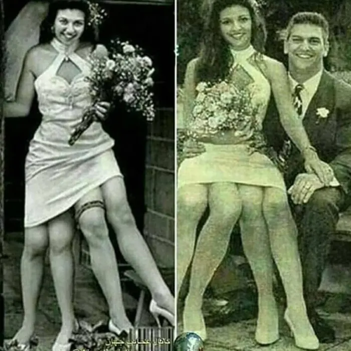 สาวคนนี้มีขา 4 ตัว: เคยเป็นความฝันของห.นุ่ม ๆ หลาย ๆ คนตอนนี้เป็นอย่างไร?