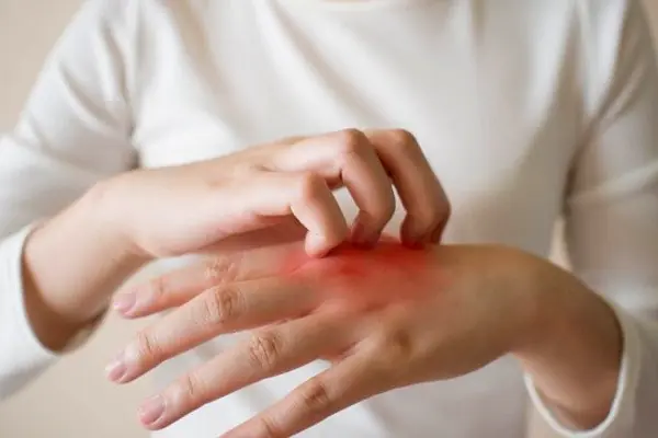 คันตอนกลางคืนไม่ควรมองข้าม หญิงคนหนึ่งไปตรวจจึงรู้ว่าป่วยหนัก บทเรียนเรื่องการใส่ใจสุข