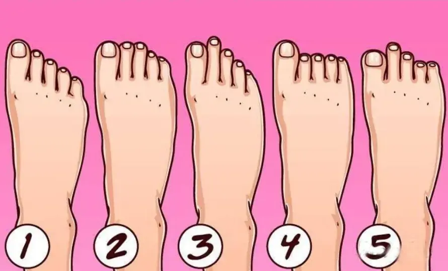 รูปร่างของเท้าของคุณ อาจบอกนิสัยลึก ๆ ที่คุณไม่เคยรู้