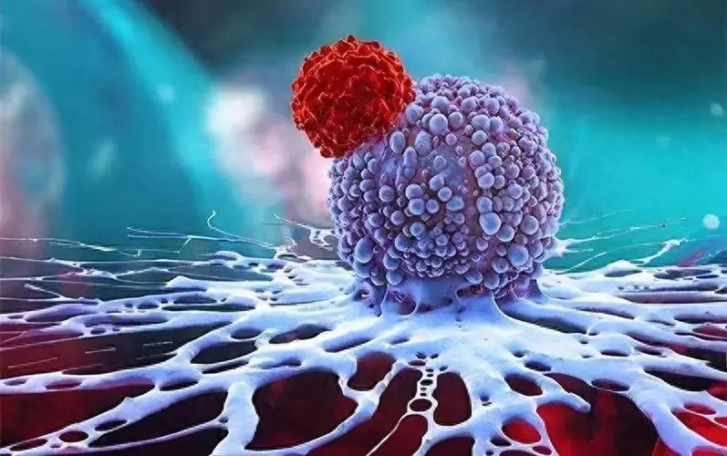 80% ของผู้ป่วยม.ะเ.ร็.งปากมดลูกสามารถป้องกันได้ หากตรวจพบเร็ว อัตราการรอดชีวิตอาจมากกว่า 90% อ