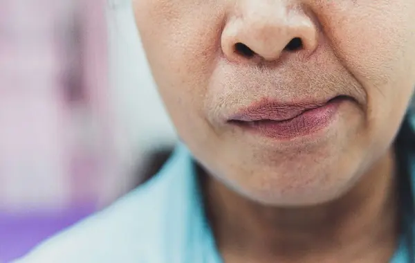 ระวังอัมพาตใบหน้า และเส้นประสาทเสียหาย จากการใช้แอร์ไม่ถูกวิธีในช่วงอากาศร้อนจัด