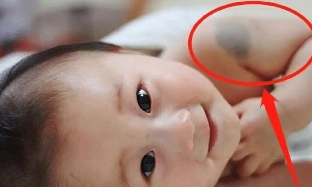 เด็กที่มีปานใน 10 ตำแหน่งต่อไปนี้ เชื่อกันว่าเป็นสัญญาณของชะตาชีวิตมั่งคั่ง ร่ำรวย เงินทอ