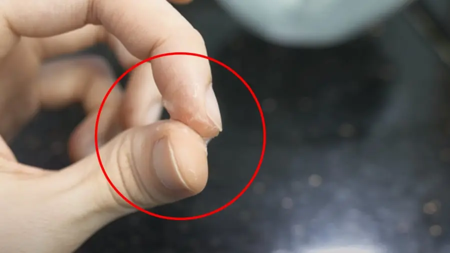 เผลอโดนกาว 502 ติดนิ้ว ดึงยังไงก็ไม่ออก หลายคนเพิ่งรู้ว่าของในบ้านช่วยได้