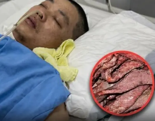 ยิ่งกินเมนูนี้บ่อย ยิ่งเสี่ยง! ผู้เชี่ยวชาญเตือน มีผู้ป่วยกว่า 2,800 ราย ความดันพุ่ง-สมองเสีย