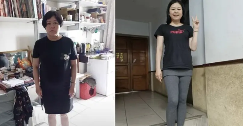 ตับไร้ไขมัน หญิงสาวพึ่งเคล็ดลับนี้ลดน้ำหนักได้เกือบ 20 กก. ประหยัดค่าผ่าตัดไปกว่า 1.4 ล้านบาท