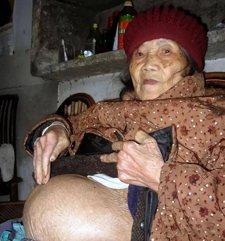 คุณยายวัย 91 ล้มจนต้องอัลตราซาวด์ แต่ภาพในท้องทำลูกชายร้องไห้ทั้งโรงพยาบาล