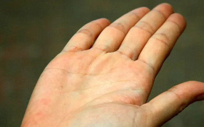 5 สัญญาณที่ร่างกายส่งออกมาเมื่อ "ตั.บ" ไม่แข็งแรง อย่านิ่งนอนใจ