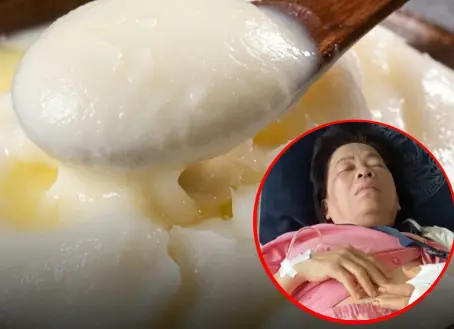 หญิงวัย 56 กิน “มันหมู” ทุกวันติดต่อกัน 1 ปีครึ่ง ผลตรวจสุขภาพทำหมอถึงกับอึ้ง