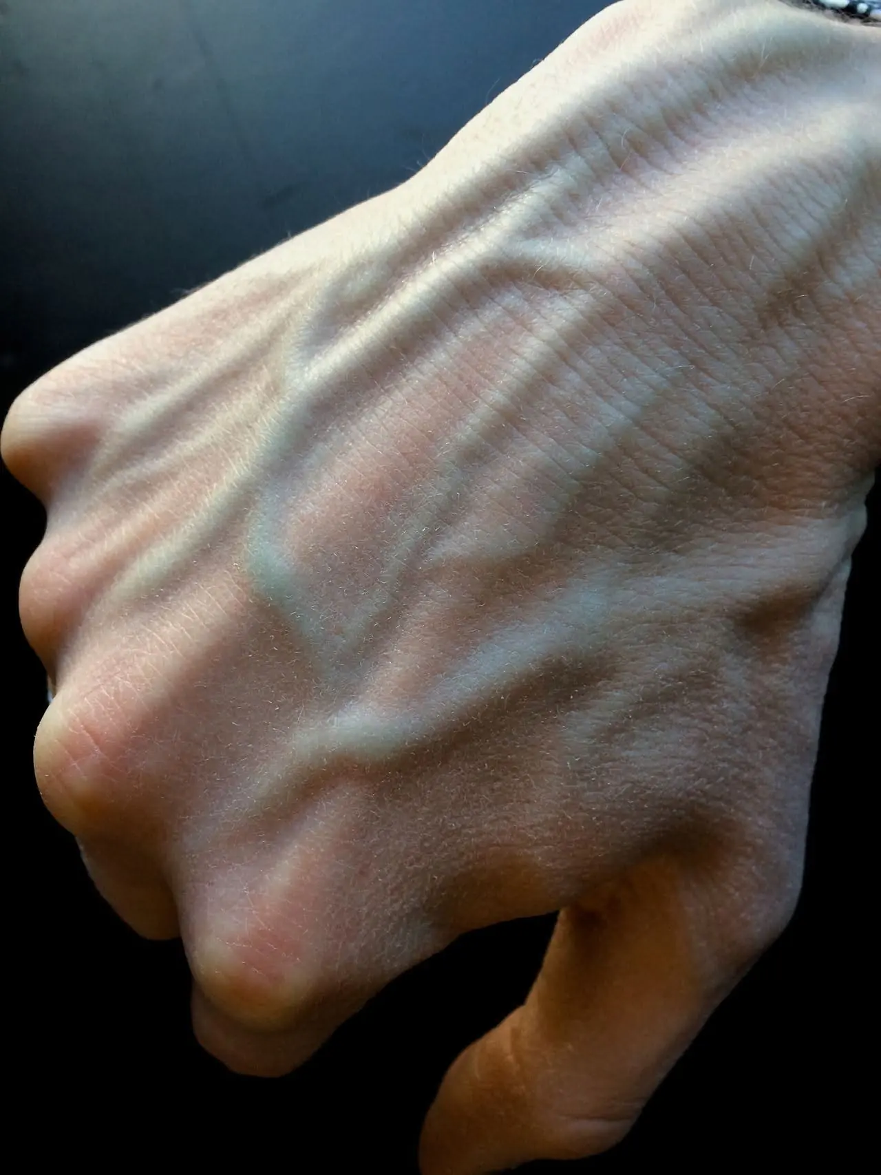หากเส้นเลือดบนมือของคุณมองเห็นชัด นั่นอาจเป็นสัญญาณของ...