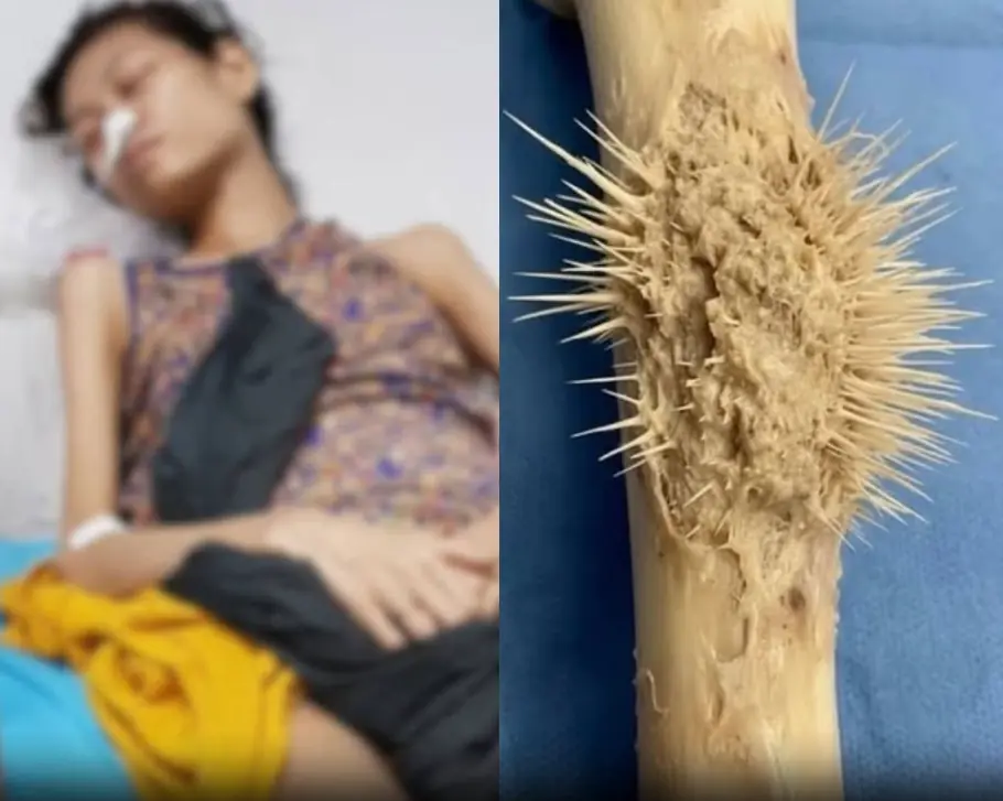 ทำความเข้าใจเกี่ยวกับภาวะความเจ็บปวดในโครงสร้างร่างกาย