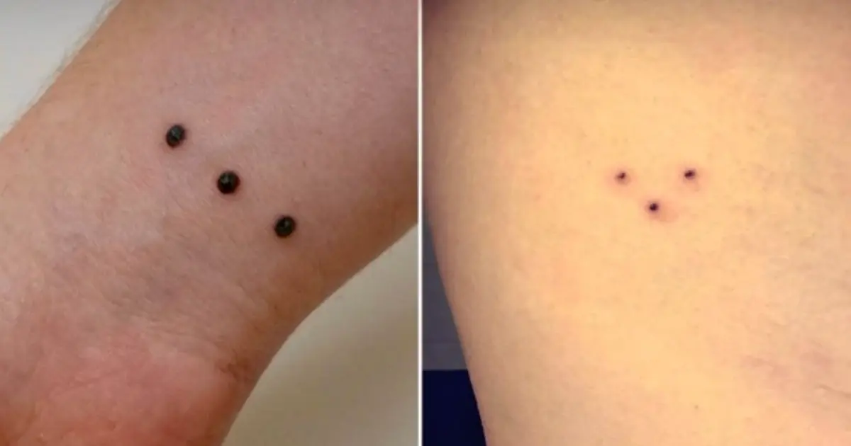 หากคุณเห็นใครมีรอยสัก “3 จุด” จริงหรือไม่ที่ควรรีบหนีให้ไกลที่สุด?
