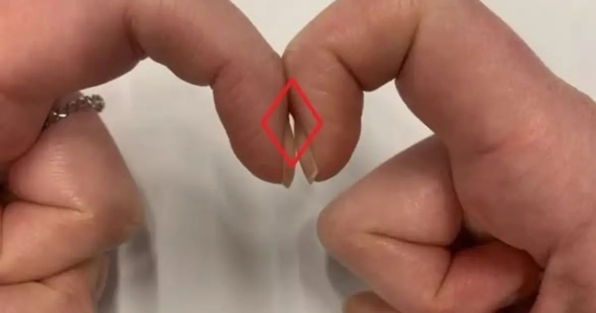 เอานิ้วชี้ทั้งสองข้างมาชนกัน ตรวจมะเ.ร็.งป.อดได้จริงหรือ? แพทย์เผยข้อเท็จจริงที่ควรรู้