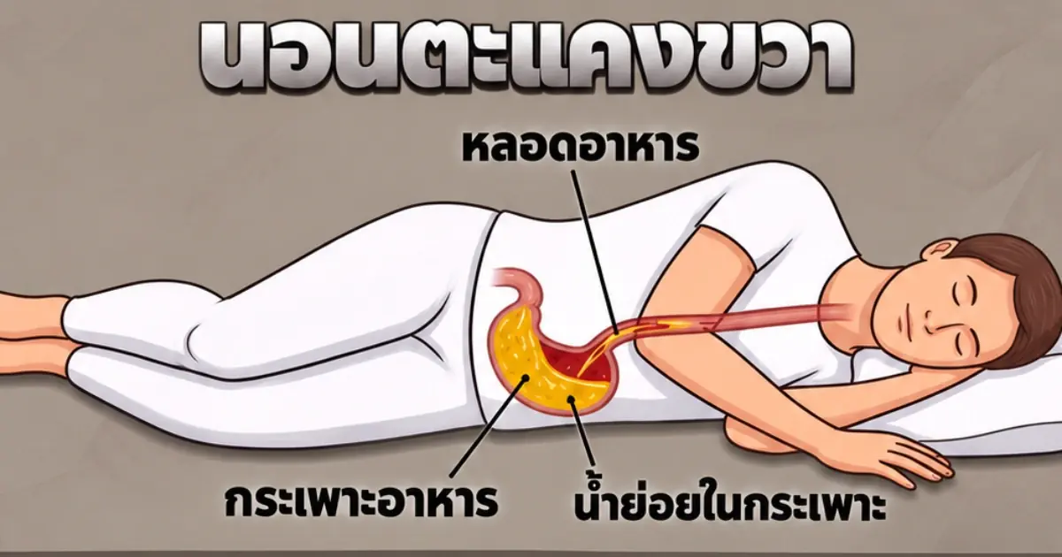 นอนตะแคงขวาหรือตะแคงซ้าย แบบไหนดีกับกระเพาะอาหารและการย่อย?