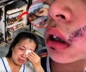 ลูกชายร้องลั่น เย็บหน้า 38 เข็ม แค่เพราะหยิบ "สิ่งนี้" จากช่องฟรีซ เตือนแช่ไว้แทบทุกบ้าน!!!